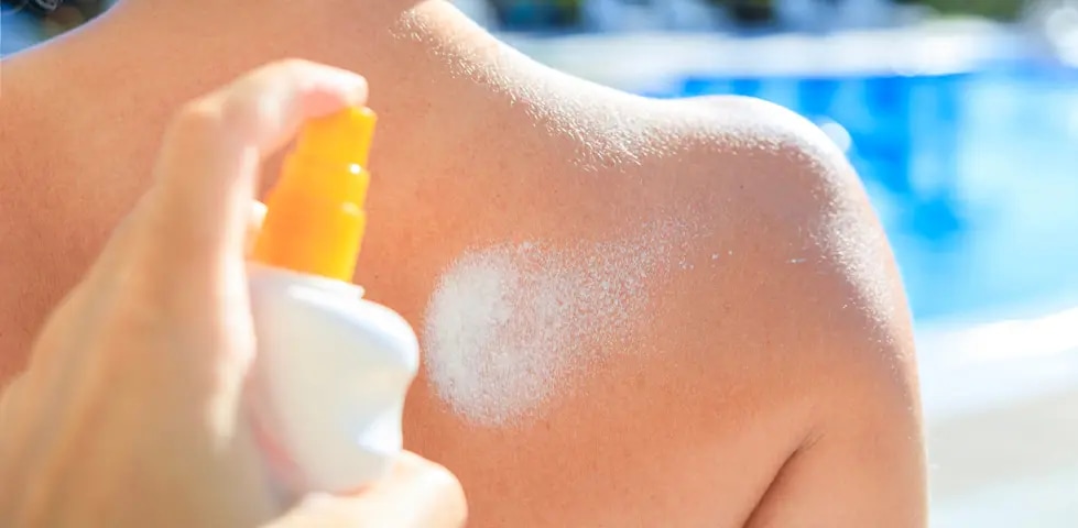 Sonnencreme bei Sonnenallergie - Tipps und Empfehlungen für einen geschützten Sommer