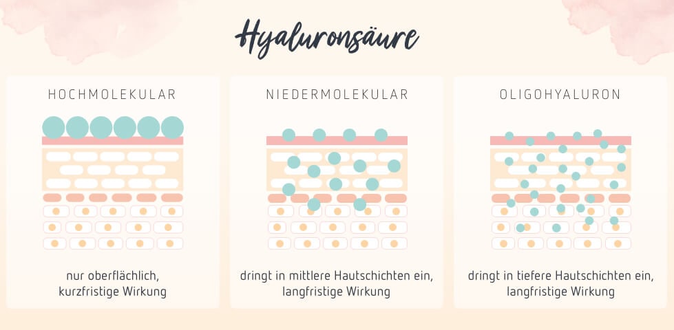 Drei Arten von Hyaluronsäre: Hchmolekulare Hyaluronsäure, niedermolekulare Hyaluronsäure und Oligohyaluron