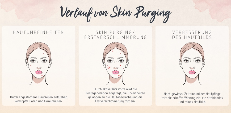 Verlauf von Skin Purging