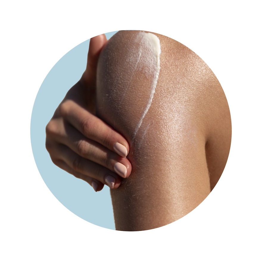 Hilfe beim Sonnenbrand